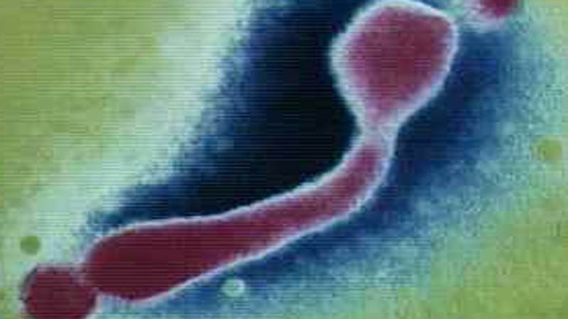 http://cdn4.list25.com/wp-content/uploads/2012/08/Mycoplasma-genitalium.png