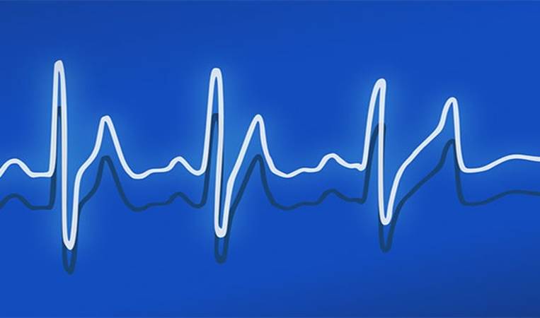 Your heart beat adjusts according to the music you are listening to