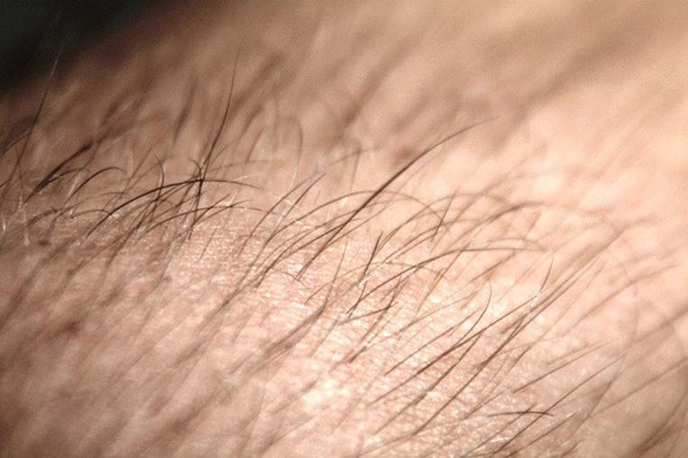 arm hair follicles