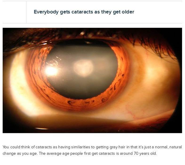 Interesting eye facts4 Interesting eye facts