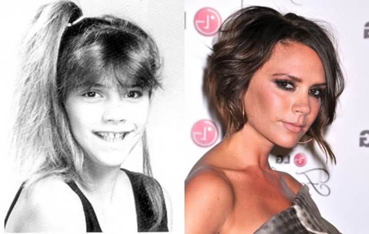 celebrities when they were young and now 15