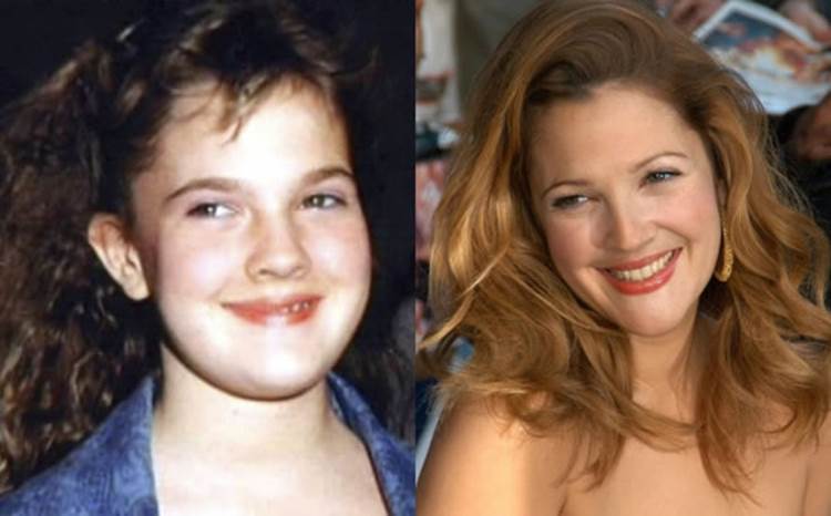 celebs when they were young and now 5